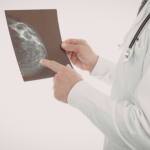 Diante de alterações suspeitas na mamografia, a avaliação médica especializada é essencial, destaca Vinicius Tadeu Sattin Rodrigues.