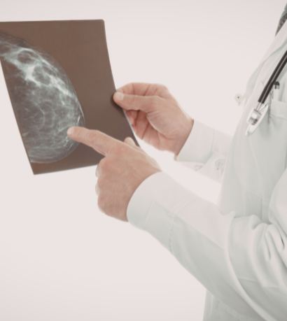 Diante de alterações suspeitas na mamografia, a avaliação médica especializada é essencial, destaca Vinicius Tadeu Sattin Rodrigues.