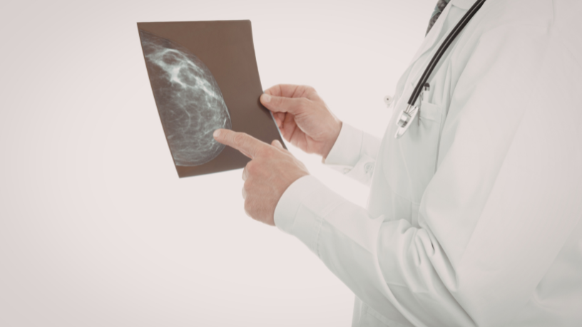 Diante de alterações suspeitas na mamografia, a avaliação médica especializada é essencial, destaca Vinicius Tadeu Sattin Rodrigues.